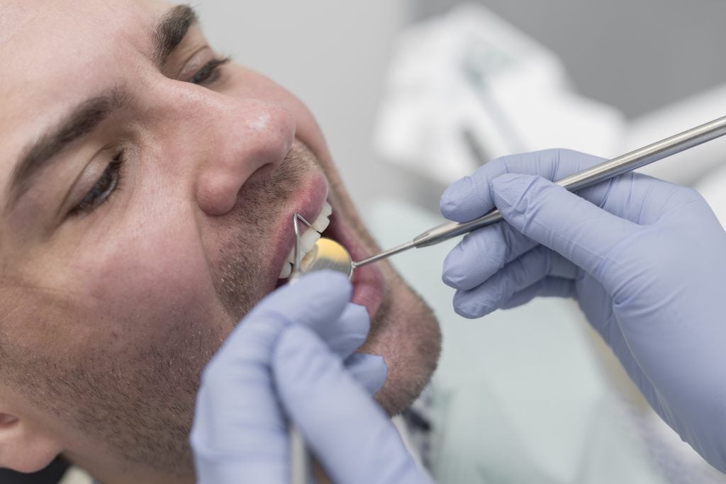 root canal treatment baulkham hills