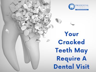 Understanding the Importance of a Bright Smile with Prodental Clinic