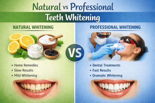 Natural vs Professional Teeth Whitening 